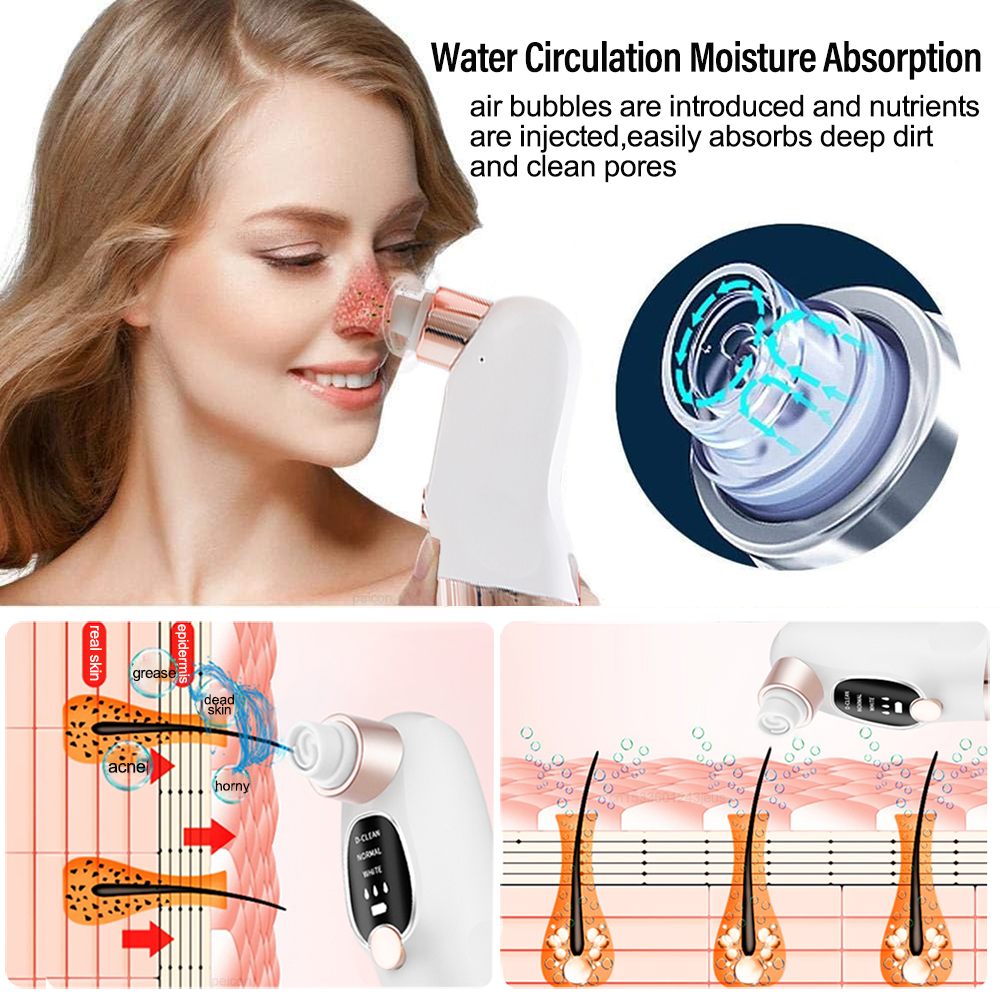 Electric Blackhead Remover Ski – Embroidery Removal recenzja i cena