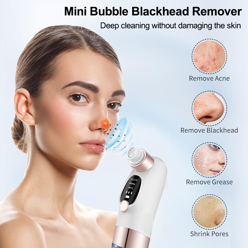 Electric Blackhead Remover Ski – Embroidery Removal recenzja i cena
